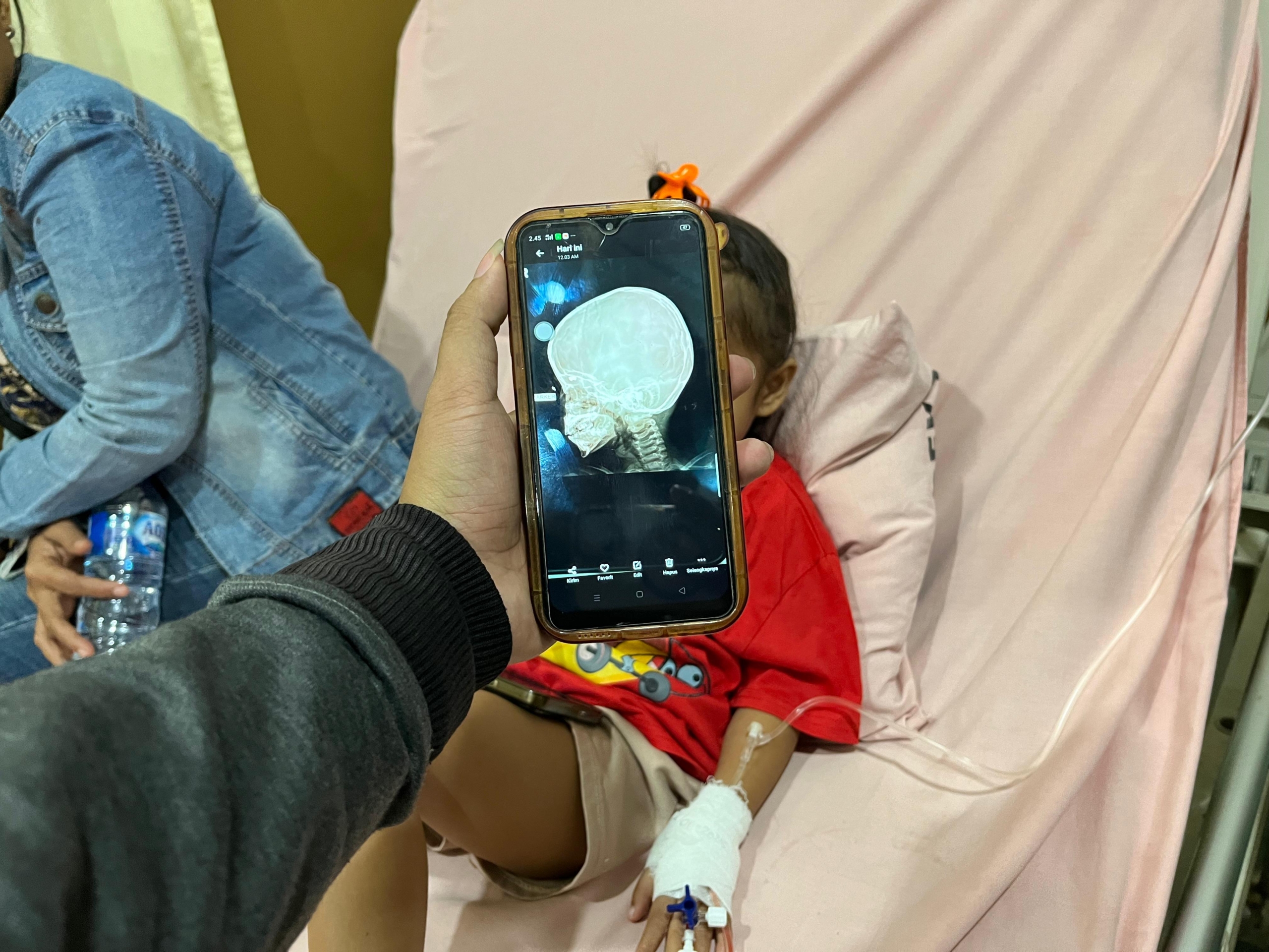 Bocah Korban Peluru Nyasar Dirawat di RS Pirngadi Medan