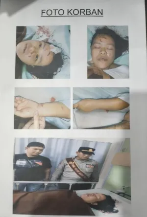 Debu Sapu dan Bau Kandang Babi Picu Penikaman IRT di Medan