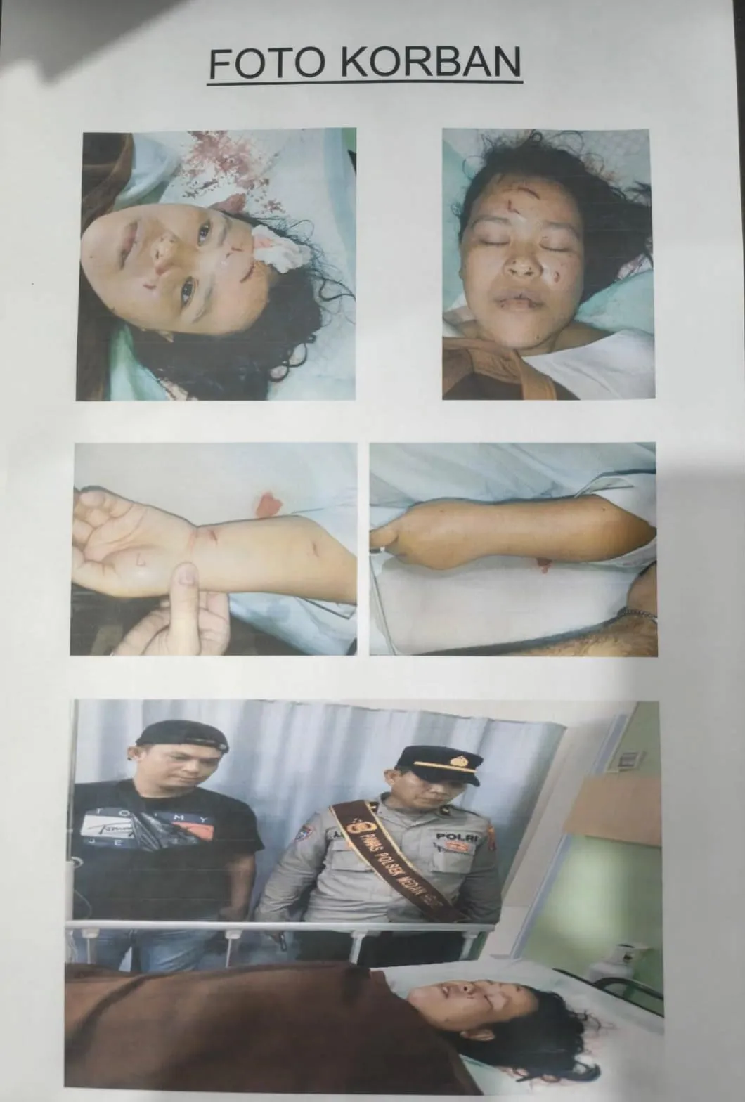 Debu Sapu dan Bau Kandang Babi Picu Penikaman IRT di Medan